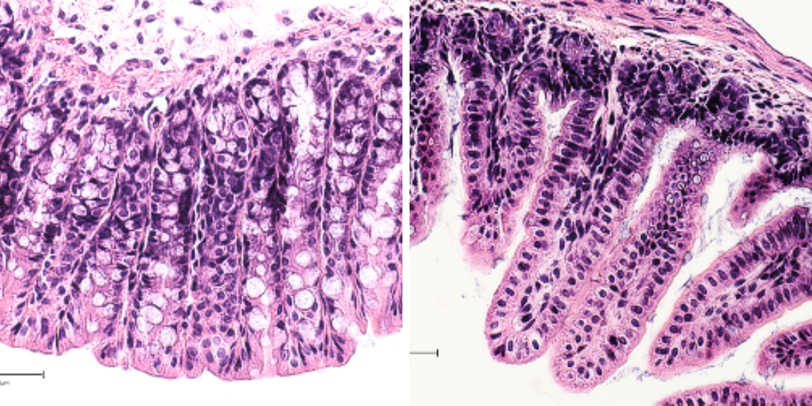 Cross-section of colon (left) and small intestine (right)